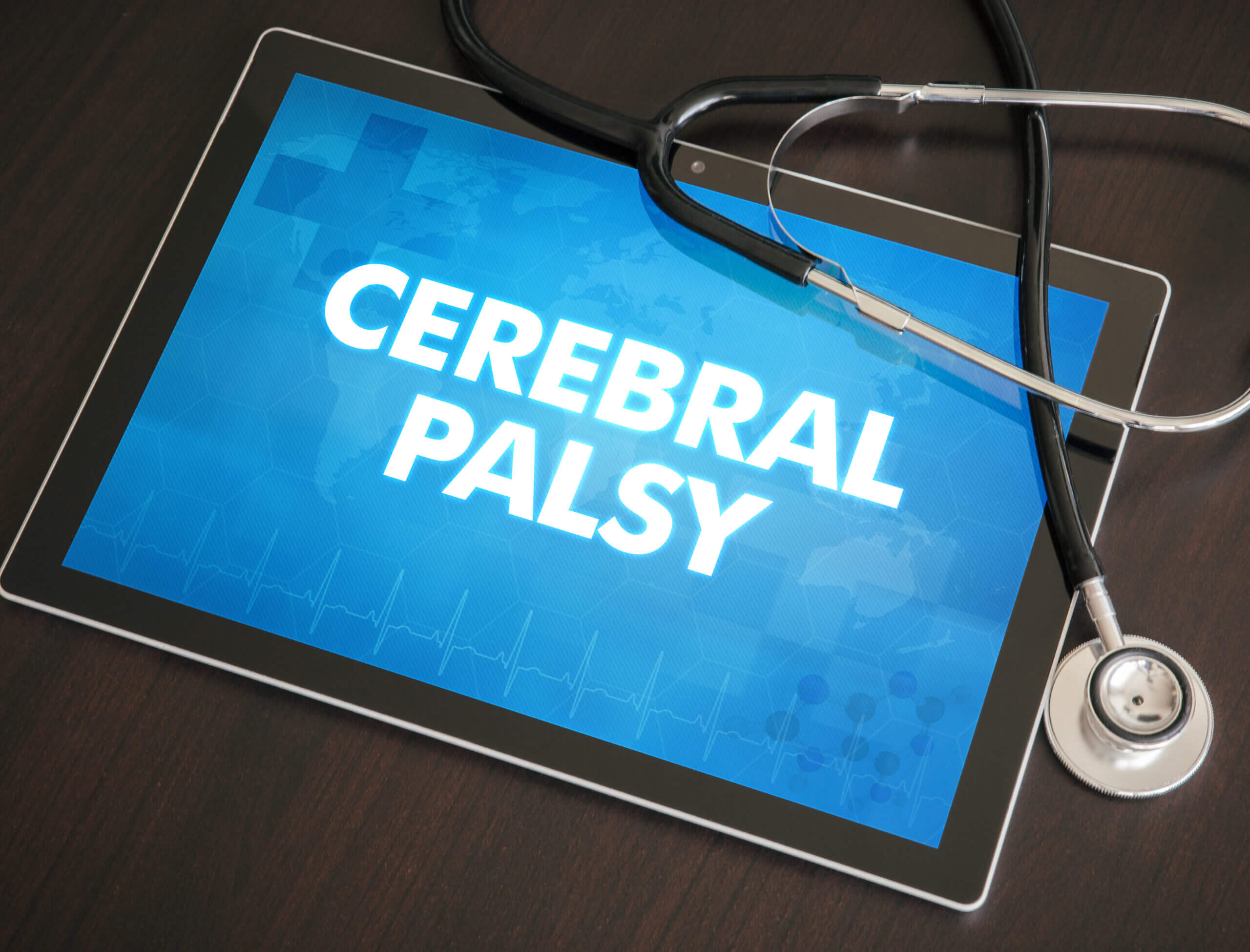 Cerebral Palsy and Medical Malpractice